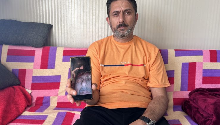 ENKAZ ALTINDA GÜLÜMSETEN DİALOG ACISINI UNUTTURDU