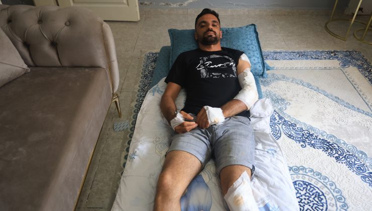 YARALANDIĞI KAZADA EHLİYETSİZ MOTOSİKLET KULLANMAKTAN 37 BİN TL’LİK CEZA UYGULANAN SÜRÜCÜDEN TEPKİ  